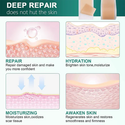 Alisanda Silicone Scar Roll – Heals Scars, Keloids & C-Section Marks Fast