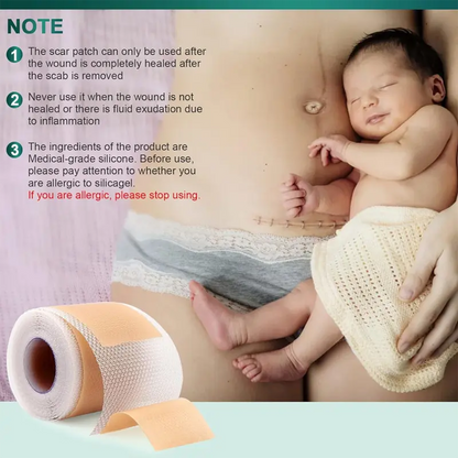 Alisanda Silicone Scar Roll – Heals Scars, Keloids & C-Section Marks Fast